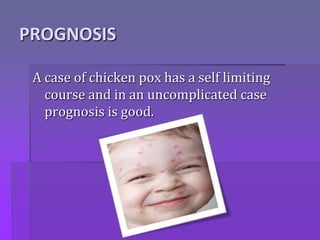 PROGNOSIS
A case of chicken pox has a self limiting
course and in an uncomplicated case
prognosis is good.
 