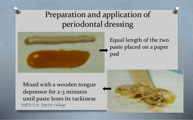 periodontal dressing