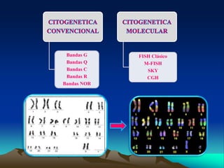 Bandas G
Bandas Q
Bandas C
Bandas R
Bandas NOR
FISH Clásico
M-FISH
SKY
CGH
 