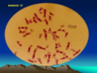 BANDAS “G”
 