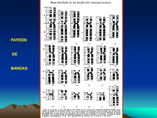 PATRÓN
DE
BANDAS
 