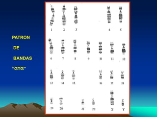 PATRON
DE
BANDAS
“GTG”
 