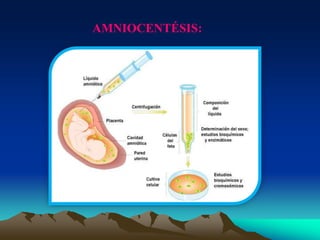 AMNIOCENTÉSIS:
 