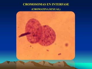 CROMOSOMAS EN INTERFASE
(CROMATINA SEXUAL)
 
