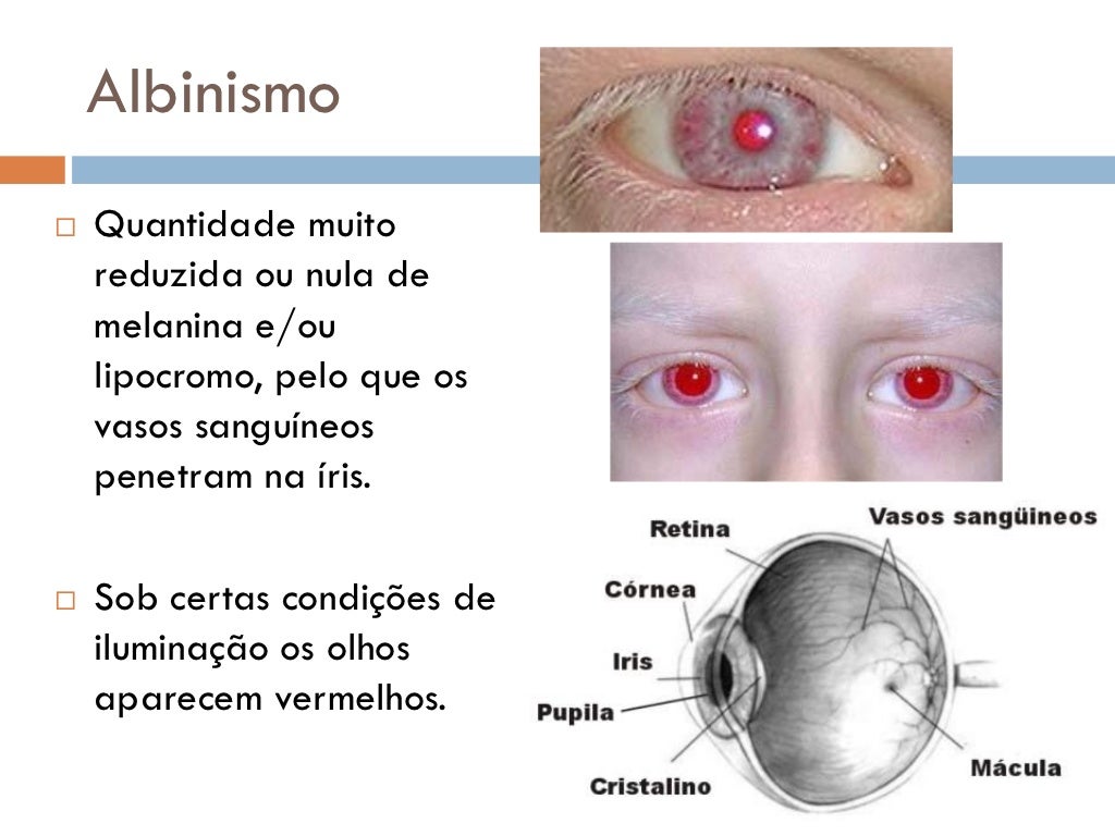 Genética Cor dos Olhos