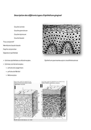 Description des différentstypes d’épithéliumgingival
Couche cornée
Couche granuleuse
Couche épineuse
Couche basale
Tissuconjonctif
Membrane basale basale
Papille conjonctive
Digitationépithéliale
+ CellulesépithélialesouKératinocytes Épithéliumpavimenteuxpluri stratifiékératinisé
+ Cellulesnonkératinocytes:
+. cellulesde Langerhans
+. cellulesde Merkel
+. Mélanocytes
 