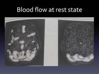 Blood flow at rest state
 