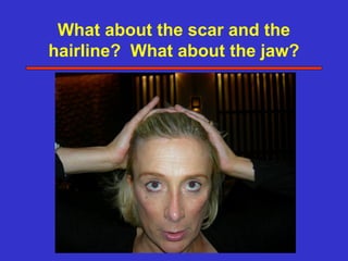 What about the scar and the
hairline? What about the jaw?
 