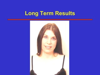 Long Term Results
 