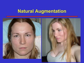 Natural Augmentation
 