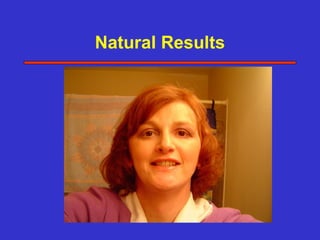 Natural Results
 