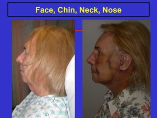Face, Chin, Neck, Nose
 