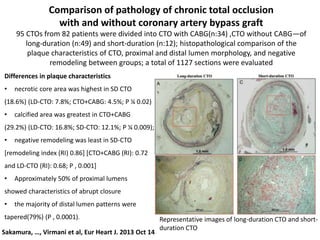 Sakamura, …, Virmani et al, Eur Heart J. 2013 Oct 14
Comparison of pathology of chronic total occlusion
with and without coronary artery bypass graft
95 CTOs from 82 patients were divided into CTO with CABG(n:34) ,CTO without CABG—of
long-duration (n:49) and short-duration (n:12); histopathological comparison of the
plaque characteristics of CTO, proximal and distal lumen morphology, and negative
remodeling between groups; a total of 1127 sections were evaluated
Representative images of long-duration CTO and short-
duration CTO
Differences in plaque characteristics
• necrotic core area was highest in SD CTO
(18.6%) (LD-CTO: 7.8%; CTO+CABG: 4.5%; P ¼ 0.02)
• calcified area was greatest in CTO+CABG
(29.2%) (LD-CTO: 16.8%; SD-CTO: 12.1%; P ¼ 0.009);
• negative remodeling was least in SD-CTO
[remodeling index (RI) 0.86] [CTO+CABG (RI): 0.72
and LD-CTO (RI): 0.68; P , 0.001]
• Approximately 50% of proximal lumens
showed characteristics of abrupt closure
• the majority of distal lumen patterns were
tapered(79%) (P , 0.0001).
 