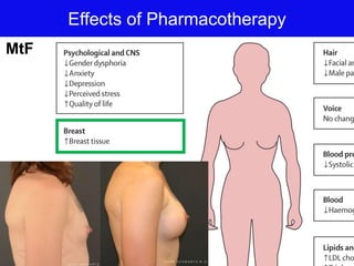Effects of Pharmacotherapy
MtF
 