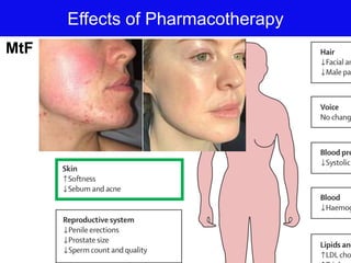Effects of Pharmacotherapy
MtF
 