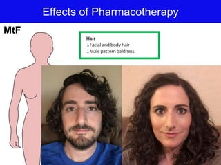 Effects of Pharmacotherapy
MtF
 