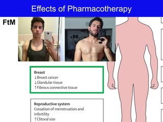 Effects of Pharmacotherapy
FtM
 