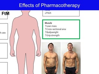 Effects of Pharmacotherapy
FtM
 