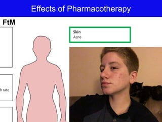 Effects of Pharmacotherapy
FtM
 