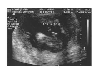 Gender  workshop presentation_final