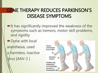 GENE THERAPY REDUCES PARKINSON’S
DISEASE SYMPTOMS
It has significantly improved the weakness of the
symptoms such as tremors, motor skill problems,
and rigidity
Done with local
anesthesia, used
a harmless, inactive
virus [AAV-2 ]
 