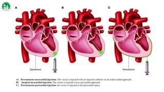 A) Percutaneous myocardial injection. The vector is injected with an injection catheter via an endo-cardial approach.
B) Surgical myocardial injection. The vector is injected via an epi-cardial approach.
C) Percutaneous pericardial injection. the vector is injected in the pericardial space.
 