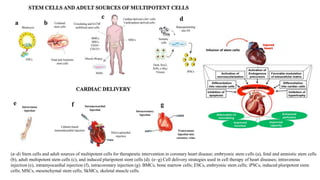 (a–d) Stem cells and adult sources of multipotent cells for therapeutic intervention in coronary heart disease; embryonic stem cells (a), fetal and amniotic stem cells
(b), adult multipotent stem cells (c), and induced pluripotent stem cells (d). (e–g) Cell delivery strategies used in cell therapy of heart diseases; intravenous
injection (e), intramyocardial injection (f), intracoronary injection (g). BMCs, bone marrow cells; ESCs, embryonic stem cells; iPSCs, induced pluripotent stem
cells; MSCs, mesenchymal stem cells; SkMCs, skeletal muscle cells.
 