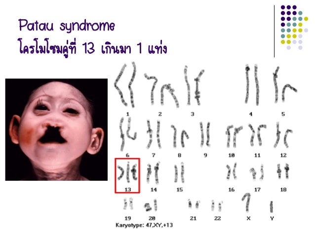 Related image