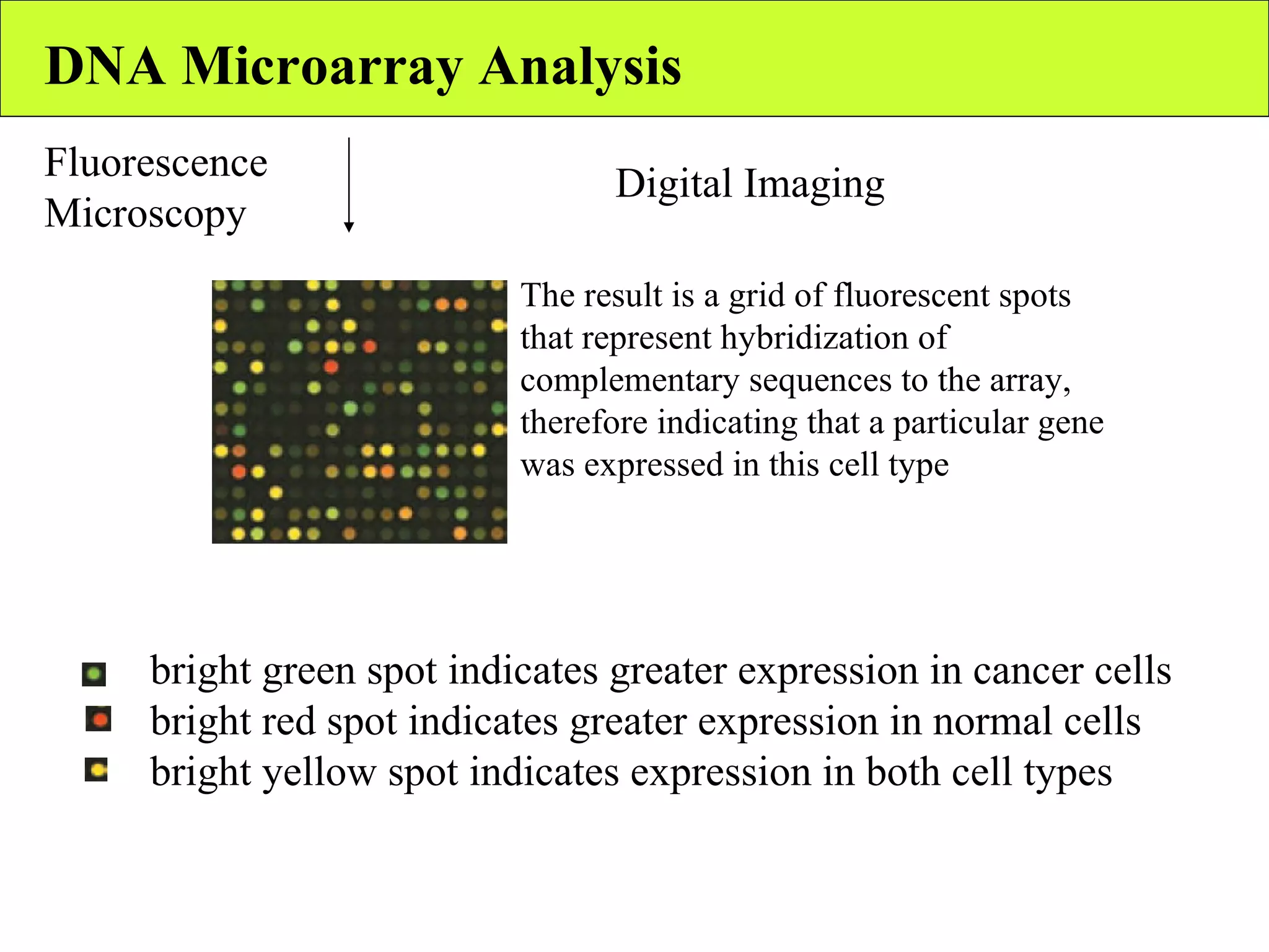 DNA Microarray Analysis Digital Imaging  The result is a grid of fluorescent spots that represent hybridization of complementary sequences to the array, therefore indicating that a particular gene was expressed in this cell type Fluorescence Microscopy bright green spot indicates greater expression in cancer cells  bright red spot indicates greater expression in normal cells bright yellow spot indicates expression in both cell types  