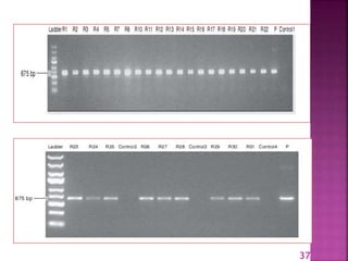 Gene for gene system in plant fungus interaction | PPTX