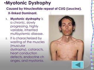 1. Myotonic dystrophy is
a chronic, slowly
progressing, highly
variable, inherited
multisystemic disease.
2. It is characterized by
wasting of the muscles
(muscular
dystrophy), cataracts,
heart conduction
defects, endocrine ch
anges, and myotonia.
•Myotonic Dystrophy
Caused by trinucleotide repeat of CUG (Leucine).
X-linked Dominant.
 