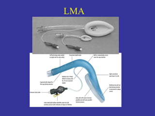 General Anesthesia | PPT