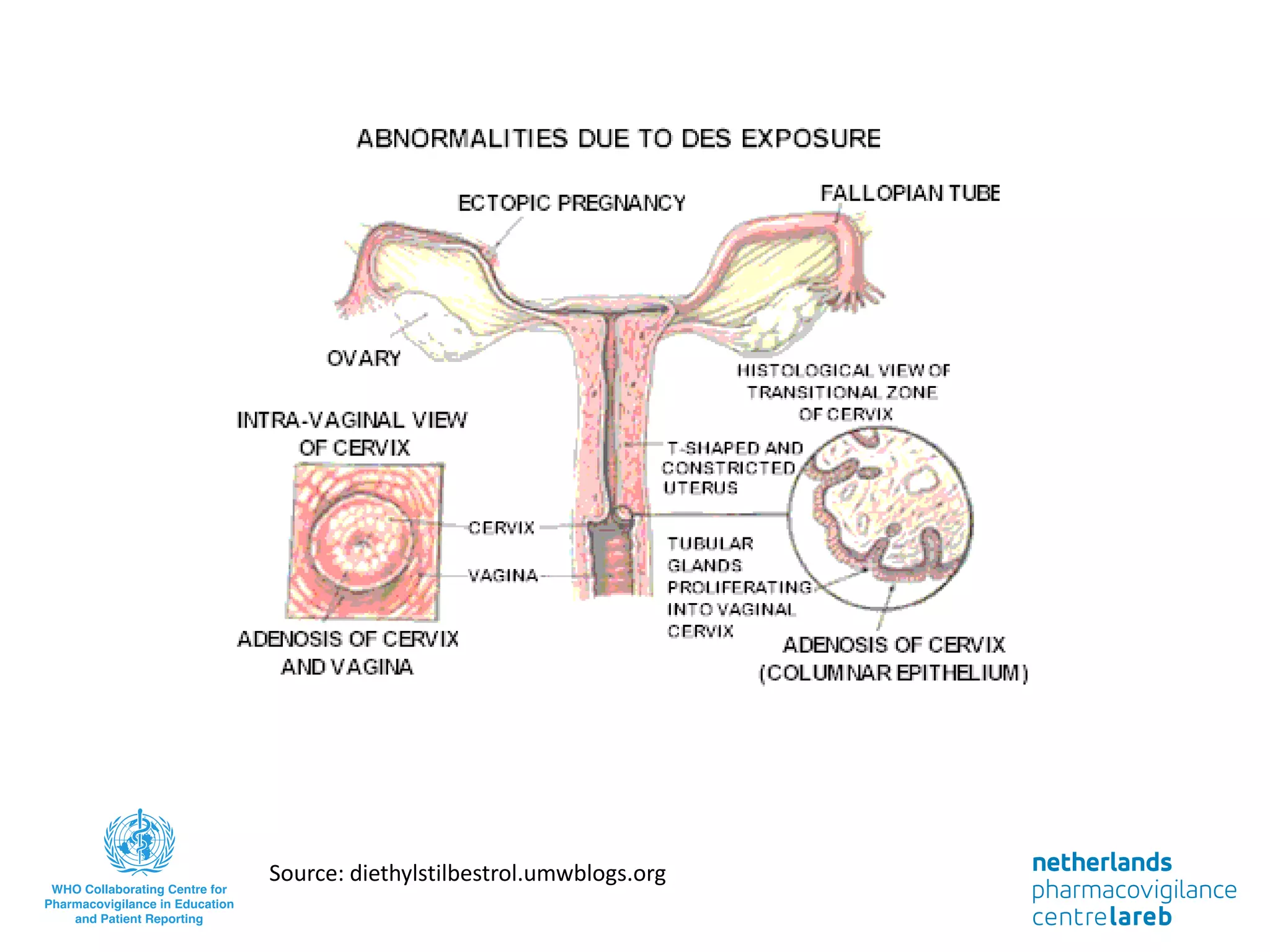 Source: diethylstilbestrol.umwblogs.org
 