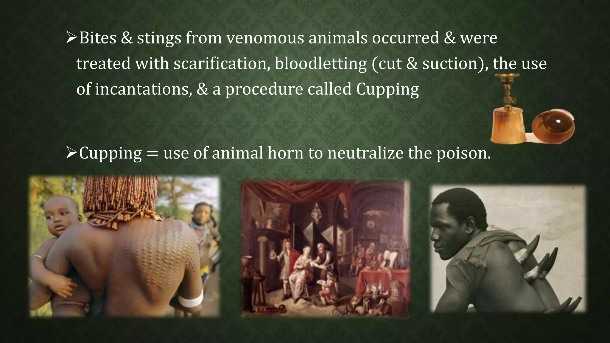 Bites & stings from venomous animals occurred & were 
treated with scarification, bloodletting (cut & suction), the use 
of incantations, & a procedure called Cupping 
Cupping = use of animal horn to neutralize the poison. 
 