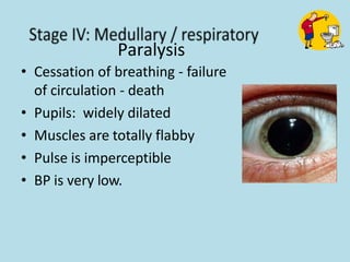 Paralysis
• Cessation of breathing - failure
of circulation - death
• Pupils: widely dilated
• Muscles are totally flabby
• Pulse is imperceptible
• BP is very low.
 