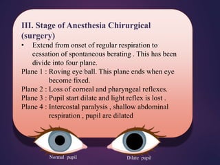 III. Stage of Anesthesia Chirurgical
(surgery)
• Extend from onset of regular respiration to
cessation of spontaneous berating . This has been
divide into four plane.
Plane 1 : Roving eye ball. This plane ends when eye
become fixed.
Plane 2 : Loss of corneal and pharyngeal reflexes.
Plane 3 : Pupil start dilate and light reflex is lost .
Plane 4 : Intercostal paralysis , shallow abdominal
respiration , pupil are dilated
Dilate pupil
Normal pupil
 
