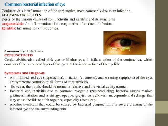 General and Ocular Microbiology.pptx | Eye and Vision Conditions ...