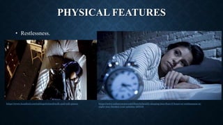 PHYSICAL FEATURES
https://www.indiatvnews.com/lifestyle/health-sleeping-less-than-6-hours-or-restlessness-at-
night-may-harden-your-arteries-460048
https://www.buzzfeed.com/tahliapritchard/walk-and-talk-please
• Restlessness.
 