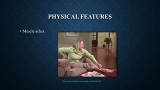 PHYSICAL FEATURES
• Muscle aches.
https://giphy.com/gifs/woman-toenails-GnHt6DuQiUtMc
 