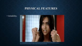 PHYSICAL FEATURES
• Irritability.
https://www.google.com/imgres?imgurl=https://thumbs.gfycat.com/HairyAdvancedHowlermonkey-
size_restricted.gif&imgrefurl=https://gfycat.com/hairyadvancedhowlermonkey&tbnid=wJDzaxXxKccOzM&vet=
1&docid=0yC0V5rem49nJM&w=534&h=251&itg=1&hl=en&source=sh/x/im
 