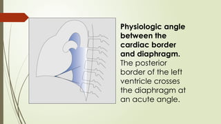 General approach to cardiac disease on radiographs (1).pptx
