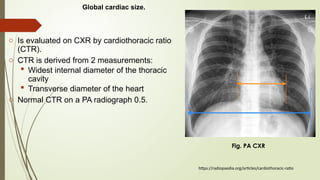 General approach to cardiac disease on radiographs (1).pptx