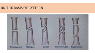 ON THE BASIS OF PATTERN
 