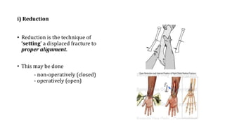 i) Reduction
• Reduction is the technique of
‘setting’ a displaced fracture to
proper alignment.
• This may be done
- non-operatively (closed)
- operatively (open)
 