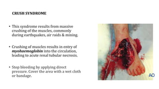 CRUSH SYNDROME
• This syndrome results from massive
crushing of the muscles, commonly
during earthquakes, air raids & mining.
• Crushing of muscles results in entry of
myohaemoglobin into the circulation,
leading to acute renal tubular necrosis.
• Stop bleeding by applying direct
pressure. Cover the area with a wet cloth
or bandage.
 