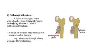 2) Pathological fracture:
A fracture through a bone
which has been made weak by some
underlying disease is called a
pathological fracture.
- A trivial or no force may be required
to cause such a fracture
-e.g., a fracture through a bone
weakened by metastasis.
 