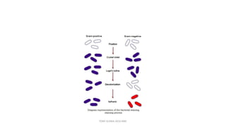 TONY SCARIA 2010 KMC
 