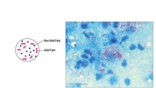 TONY SCARIA 2010 KMC
 