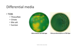 Differential media
• TCBS
• Thiosulfate
• Citrate
• Bile salt
• Sucrose
TONY SCARIA 2010 KMC
 