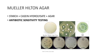 MUELLER HILTON AGAR
• STARCH + CASEIN HYDROLYSATE + AGAR
• ANTIBIOTIC SENSITIVITY TESTING
TONY SCARIA 2010 KMC
 